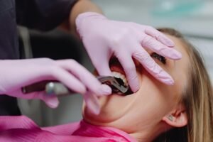 Wisdom teeth removal