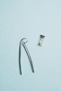 Wisdom Teeth Removal